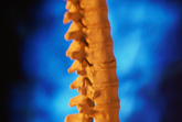Osteoporosi: nuove conferme da romosozumab