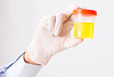 Dieta sotto controllo con il test delle urine